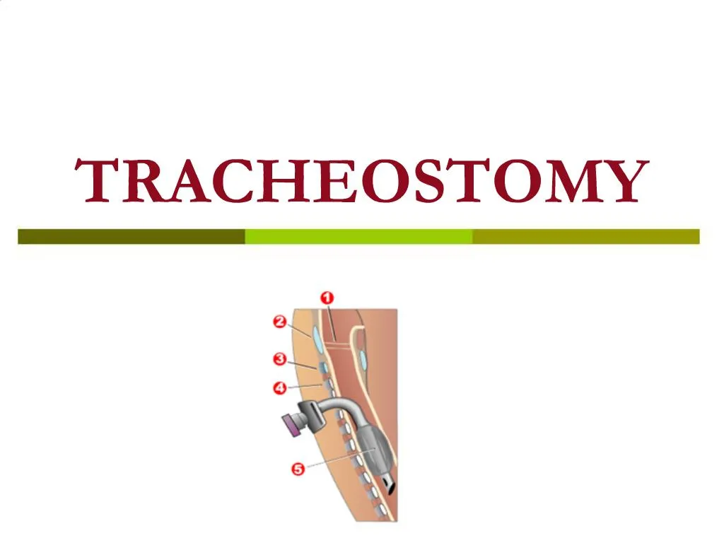 PPT - TRACHEOSTOMY PowerPoint Presentation, free download - ID:742432