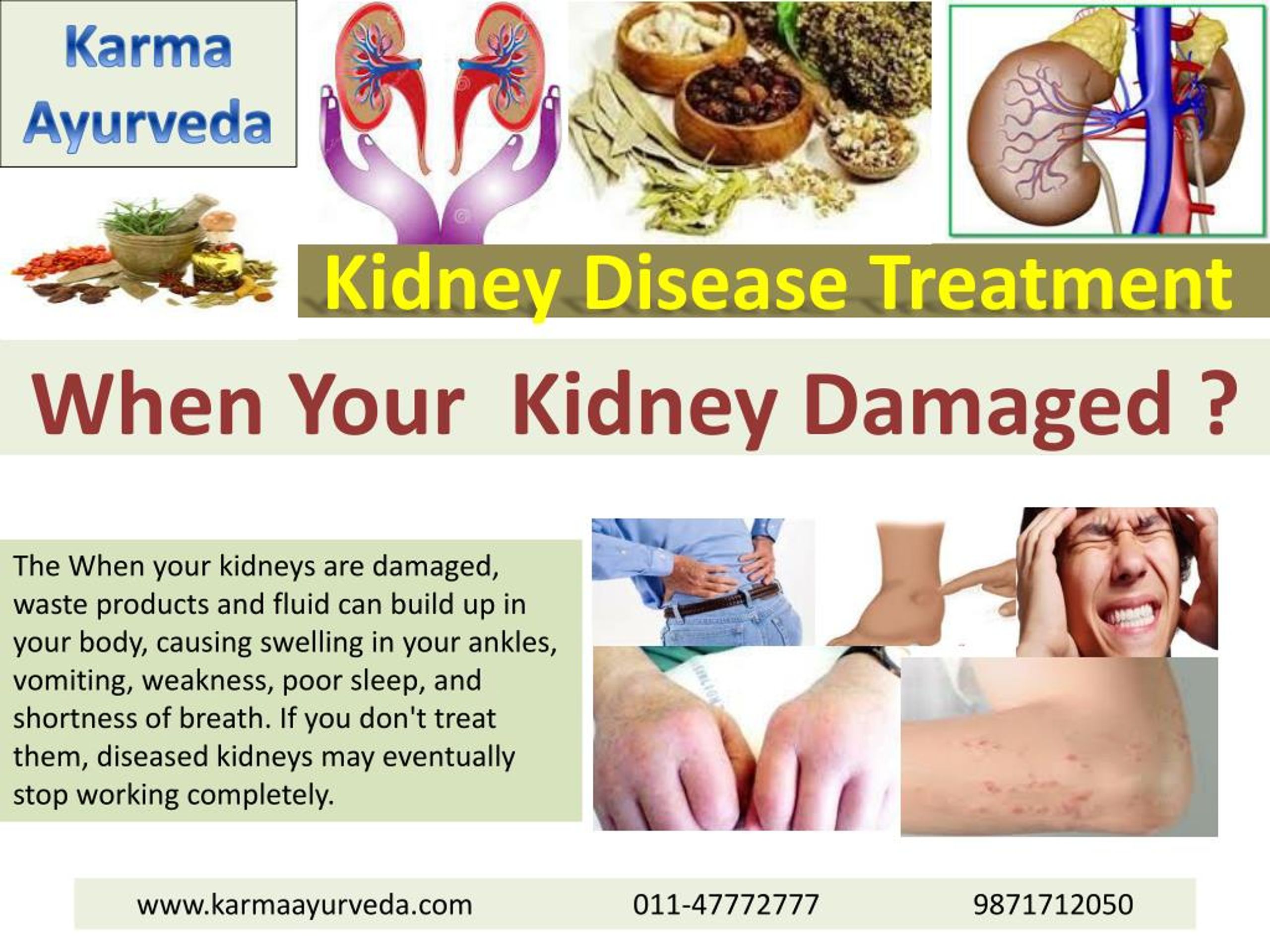kidney disease treatment1.