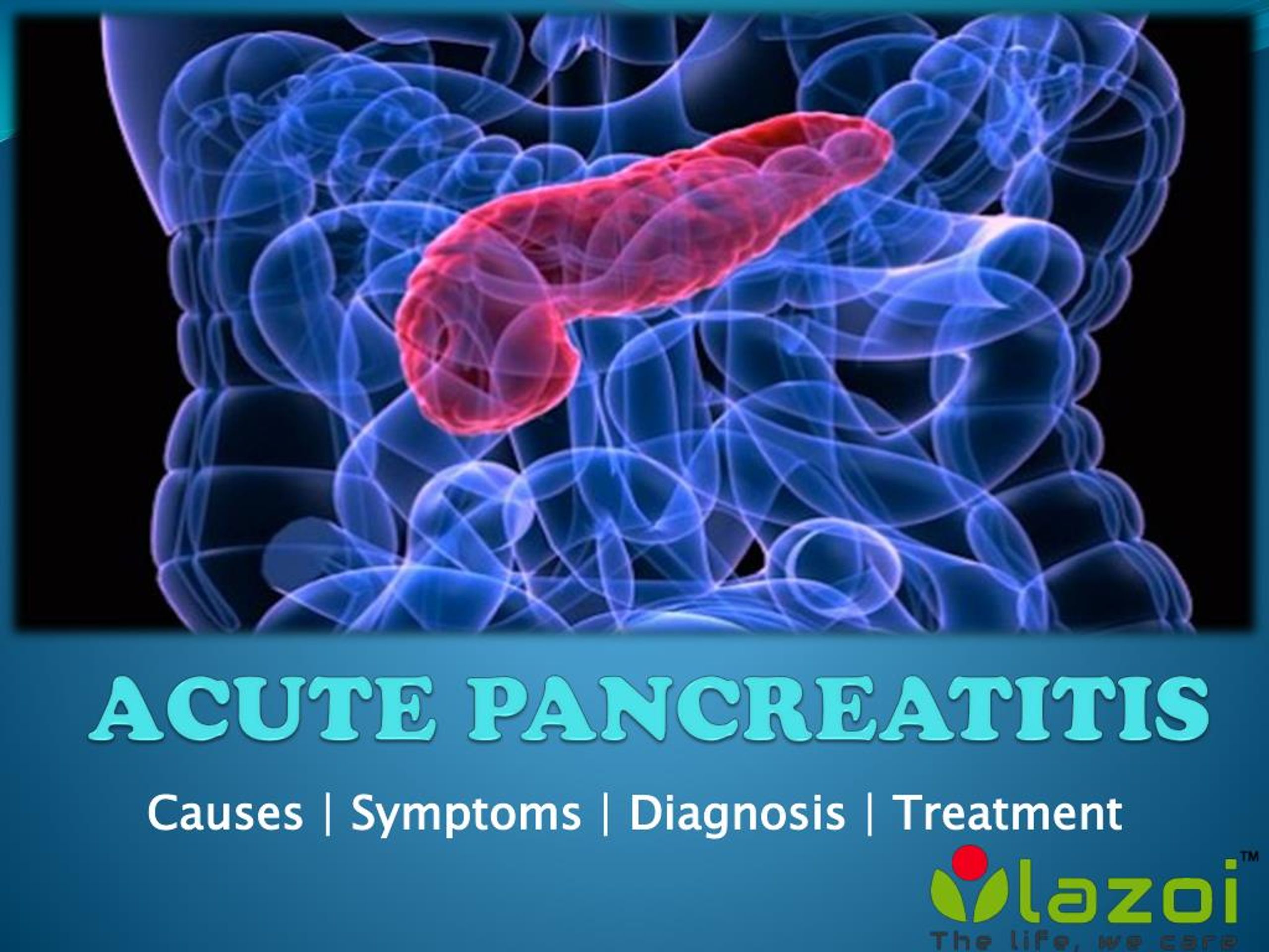 thesis topics on acute pancreatitis
