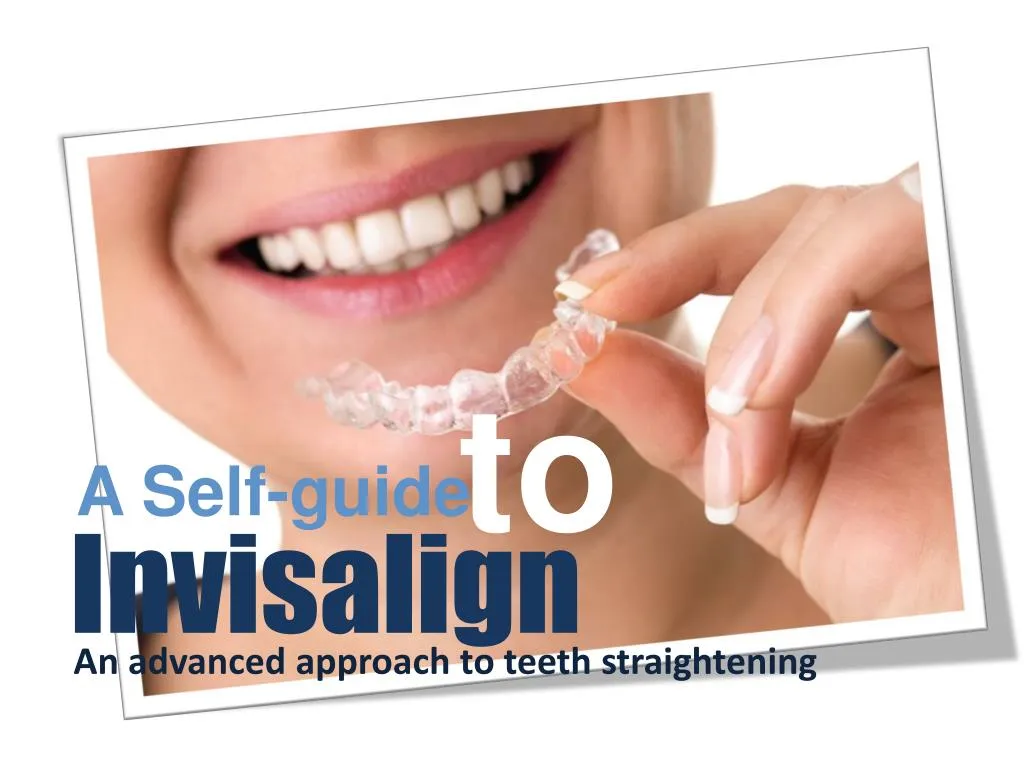 PPT All About Invisalign Treatment Invisalign London PowerPoint