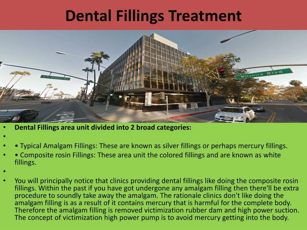 dental fillings treatment n.