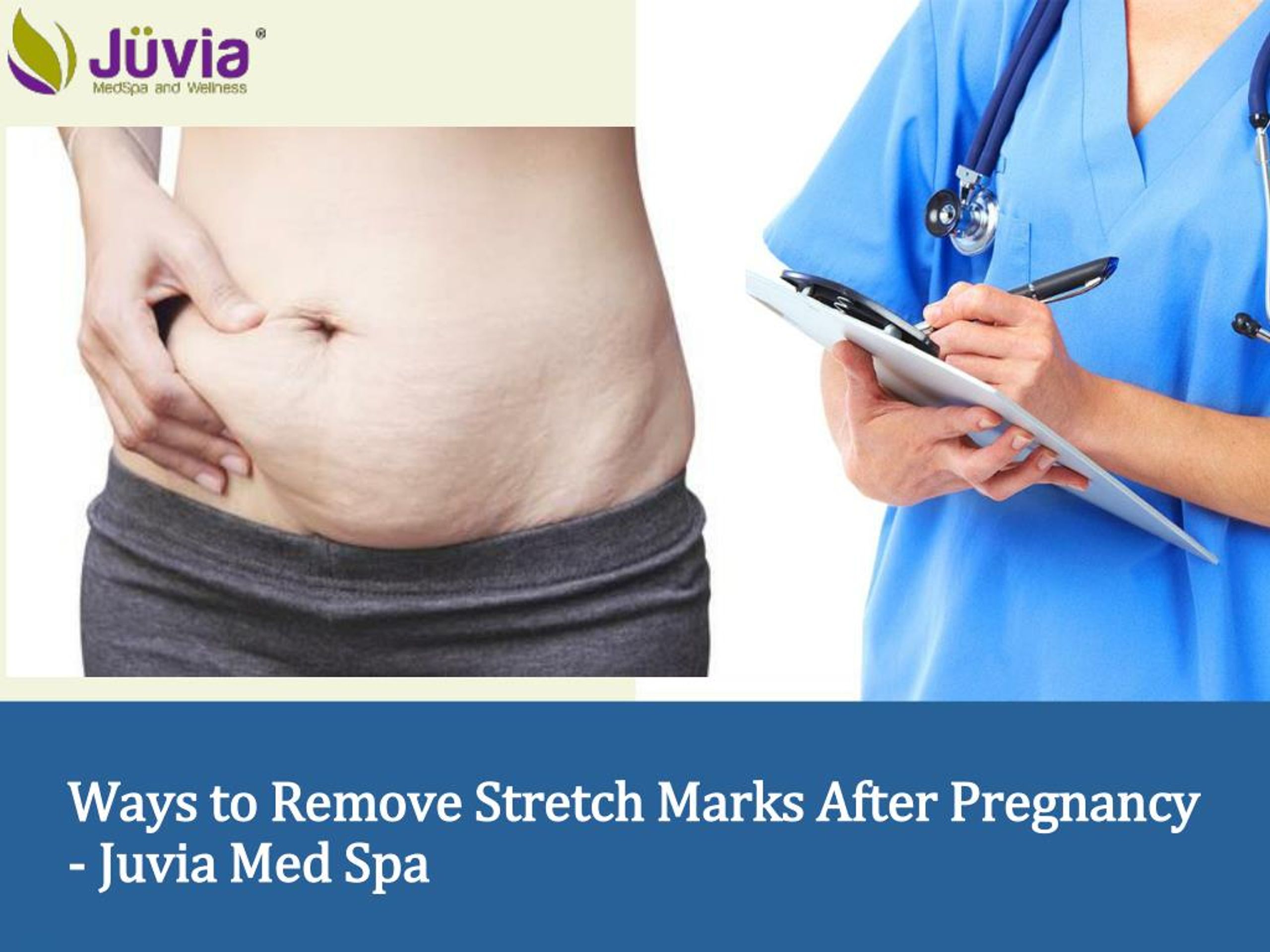 How Do Stretch Marks Happen? - Spa MDSpa MD