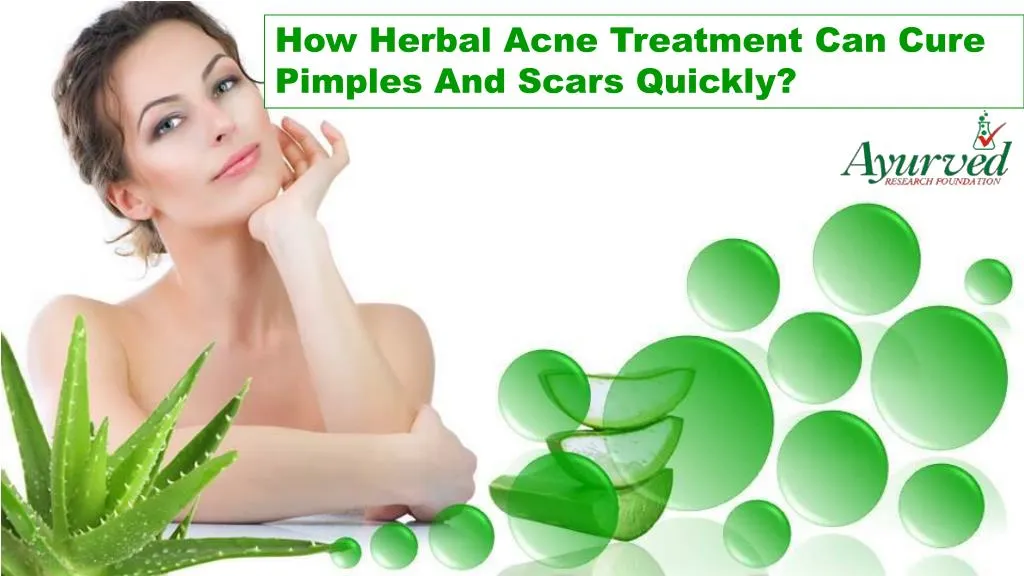 herbal acne treatment