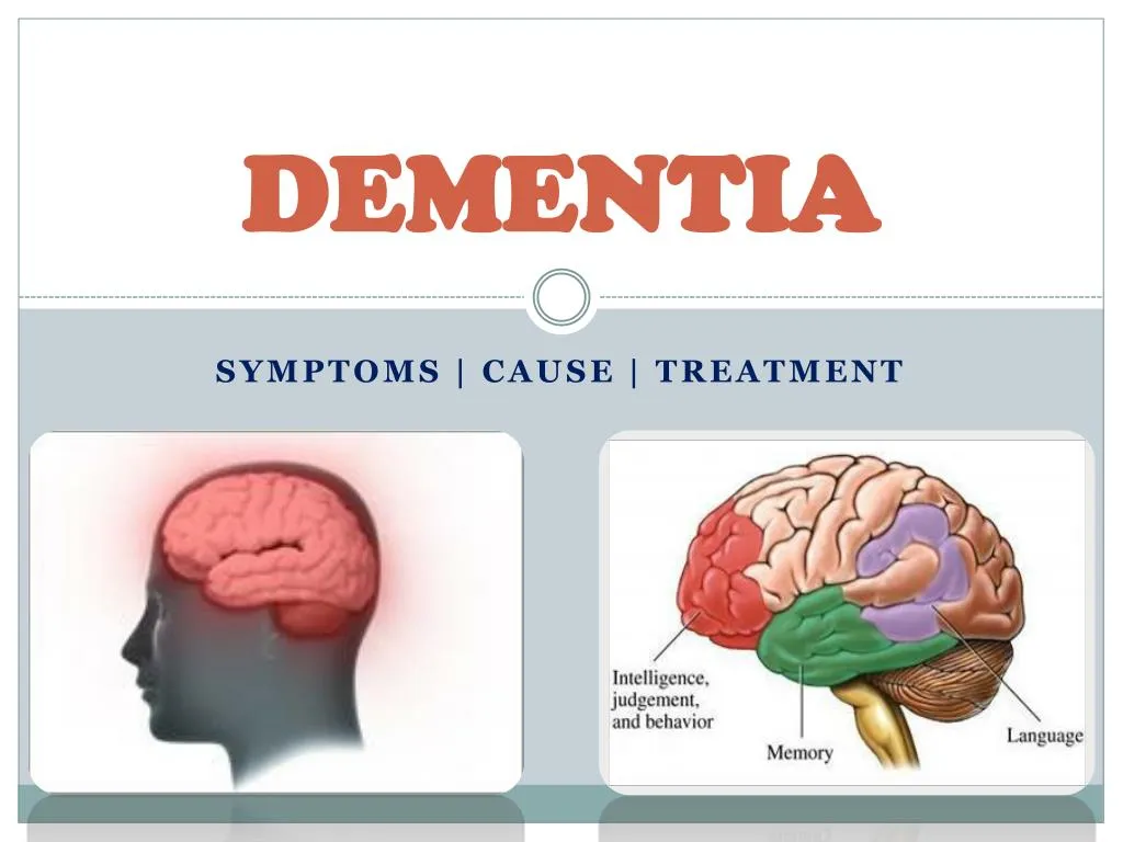 presentations of dementia