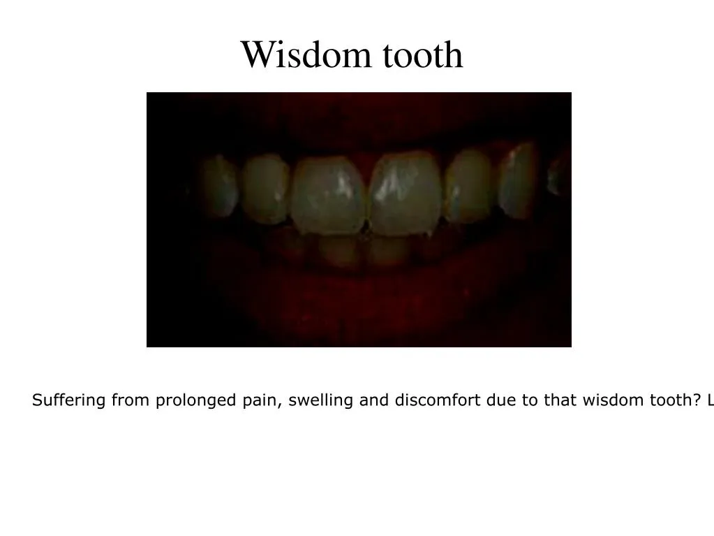 wisdom tooth n.