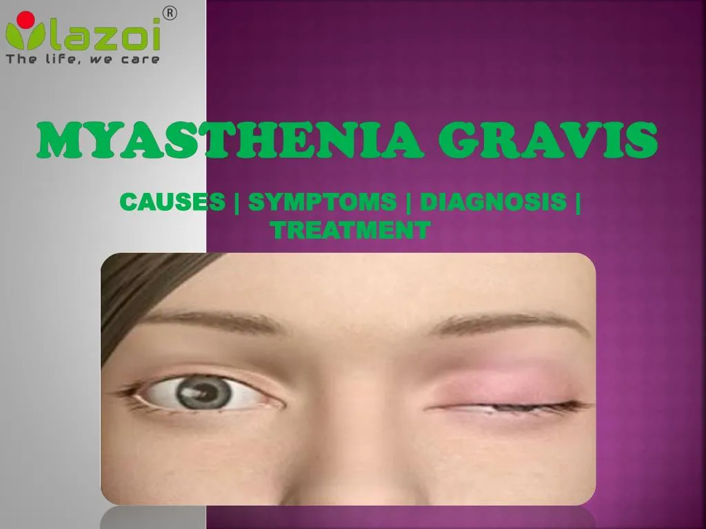 Ppt Myasthenia Gravis Symptoms Causes Diagnosis And Treatment Powerpoint Presentation Id 5558