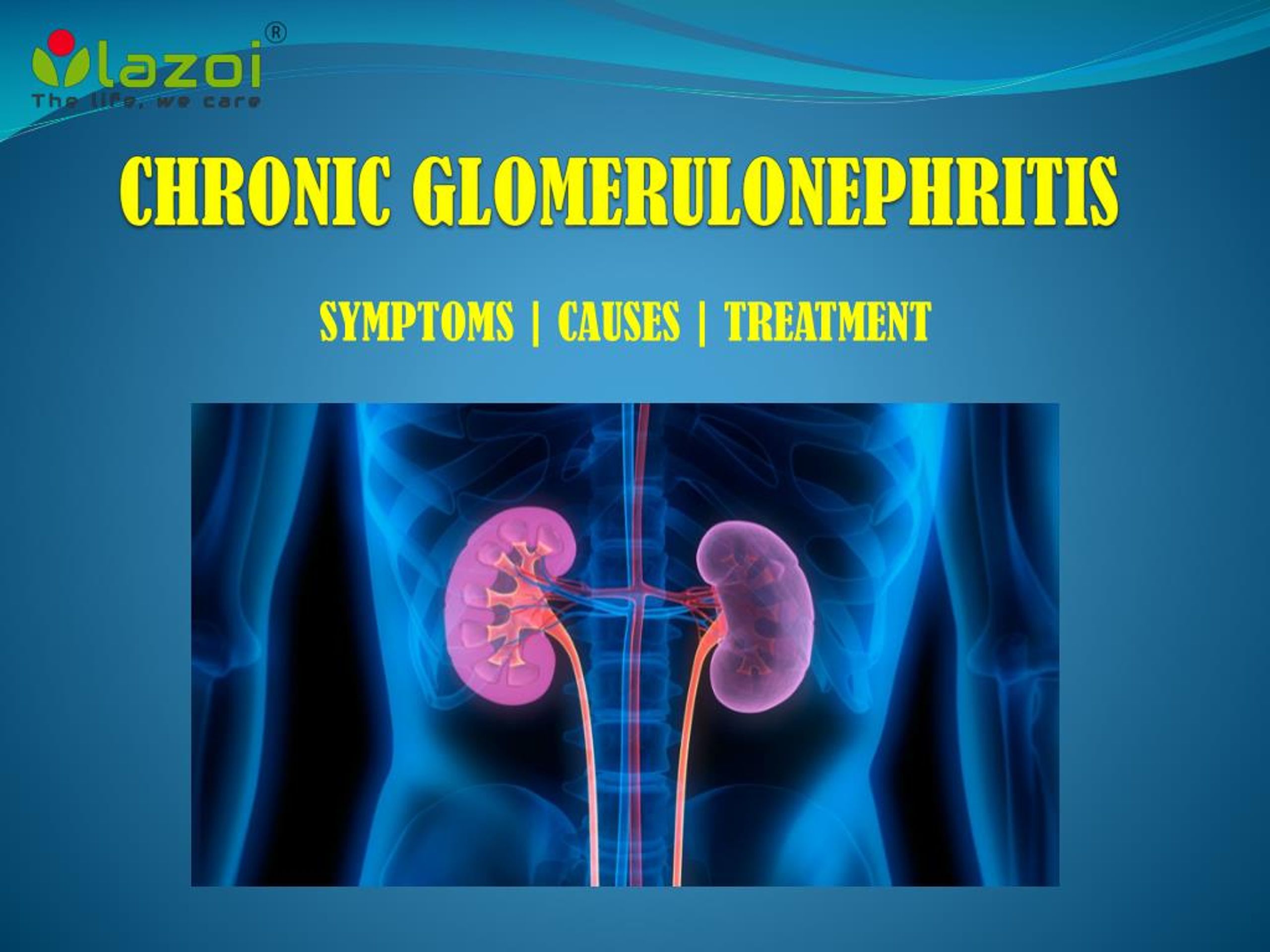 glomerulonephritis case presentation ppt