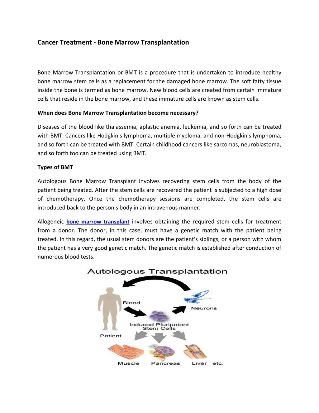 PPT - bone marrow transplant PowerPoint Presentation, free download ...