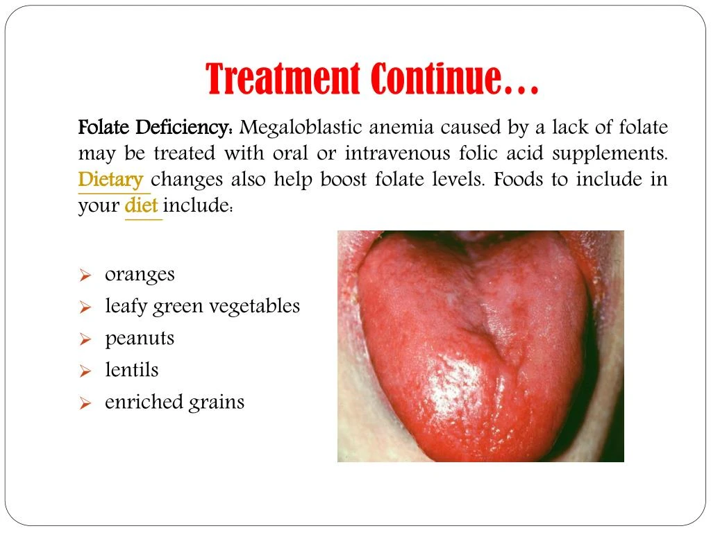 PPT - Megaloblastic Anaemia: Symptoms, causes, diagnosis, treatment and