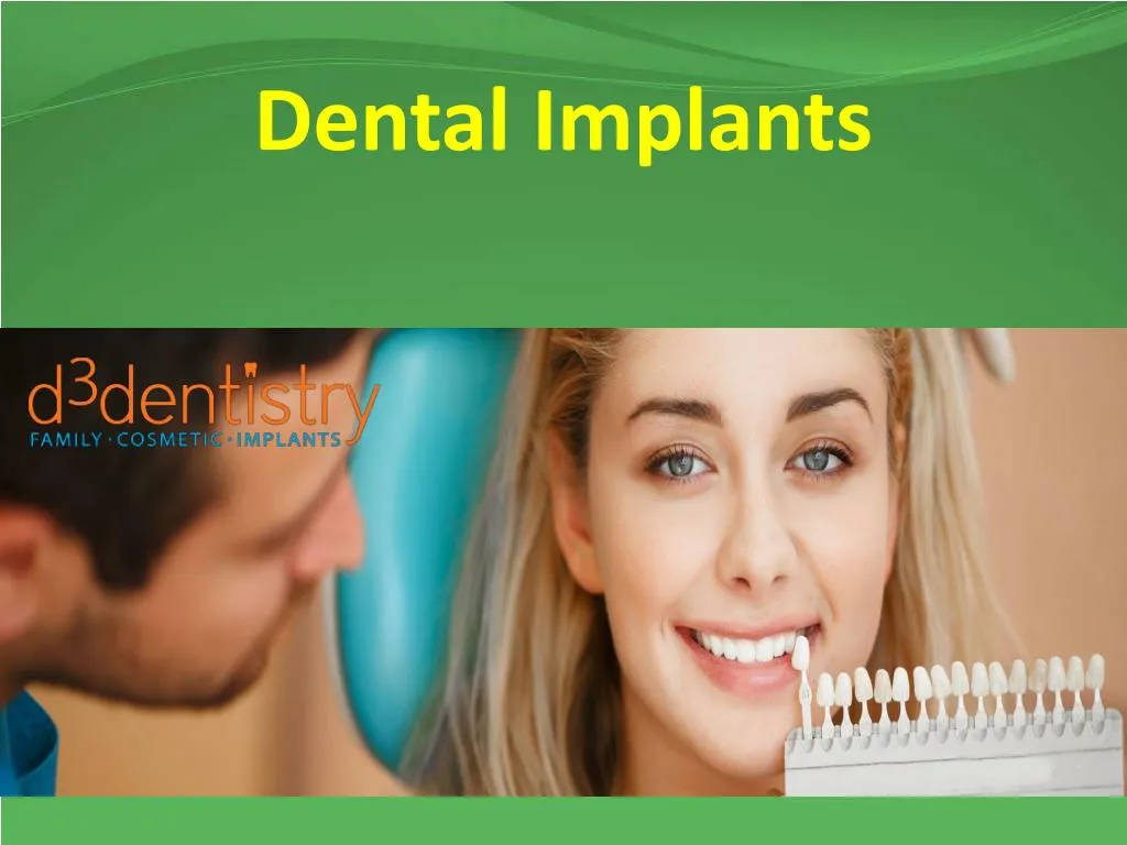 PPT - Dental Implants PowerPoint Presentation, Free Download - ID:7486907