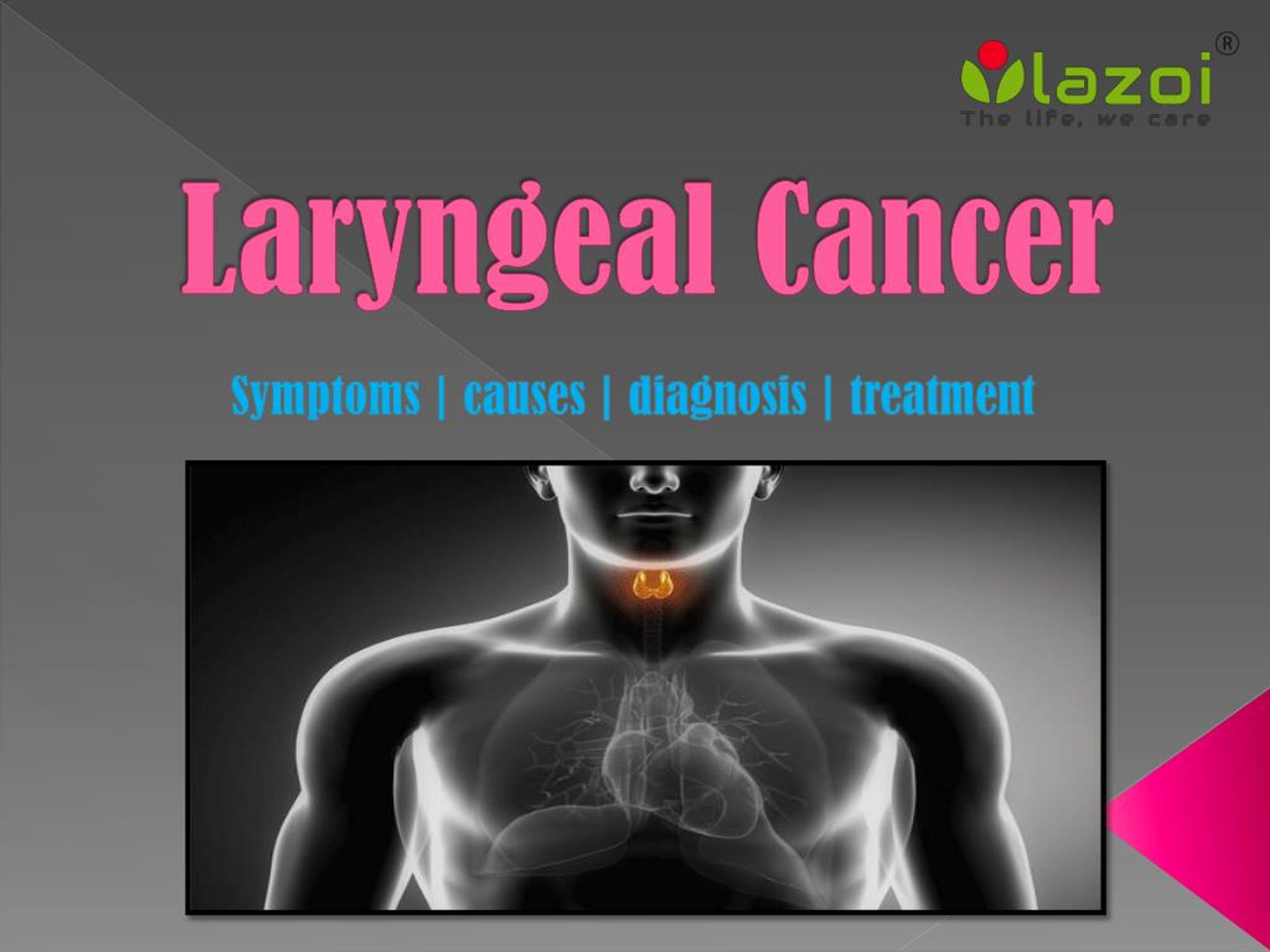 Ppt Laryngeal Cancer Symptoms Causes Diagnosis And Treatment Powerpoint Presentation Id 7233
