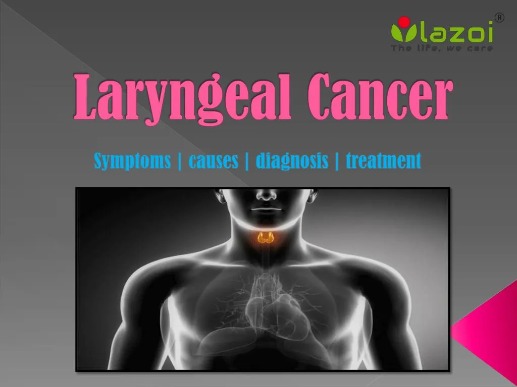 Ppt Laryngeal Cancer Symptoms Causes Diagnosis And Treatment Powerpoint Presentation Id 2839
