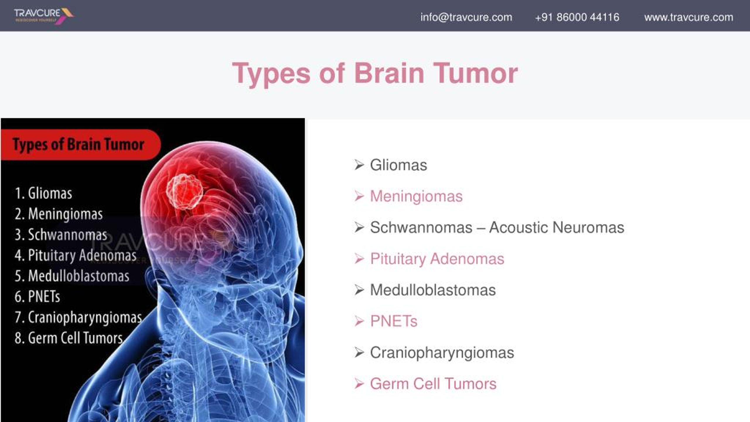 PPT - Detection and Treatment of Brain Tumors PowerPoint Presentation ...