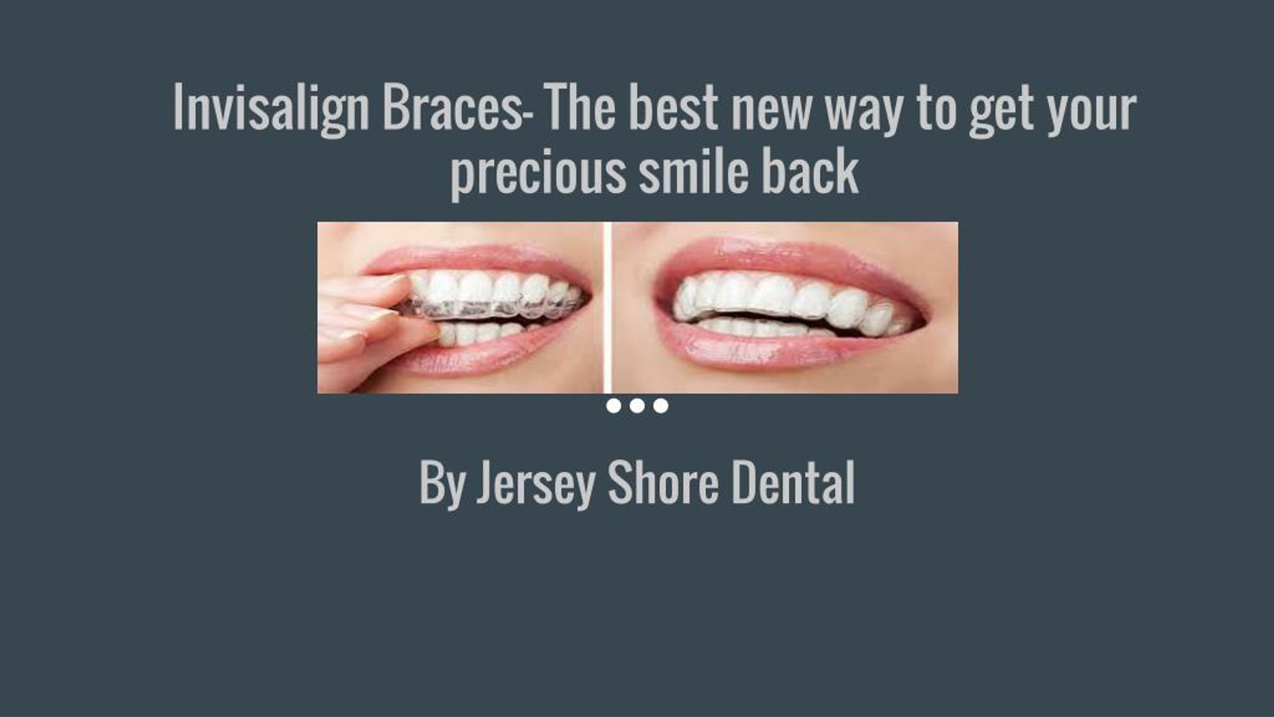 Clear Braces Wall Twp NJ  Straighten Teeth with Invisalign Clear