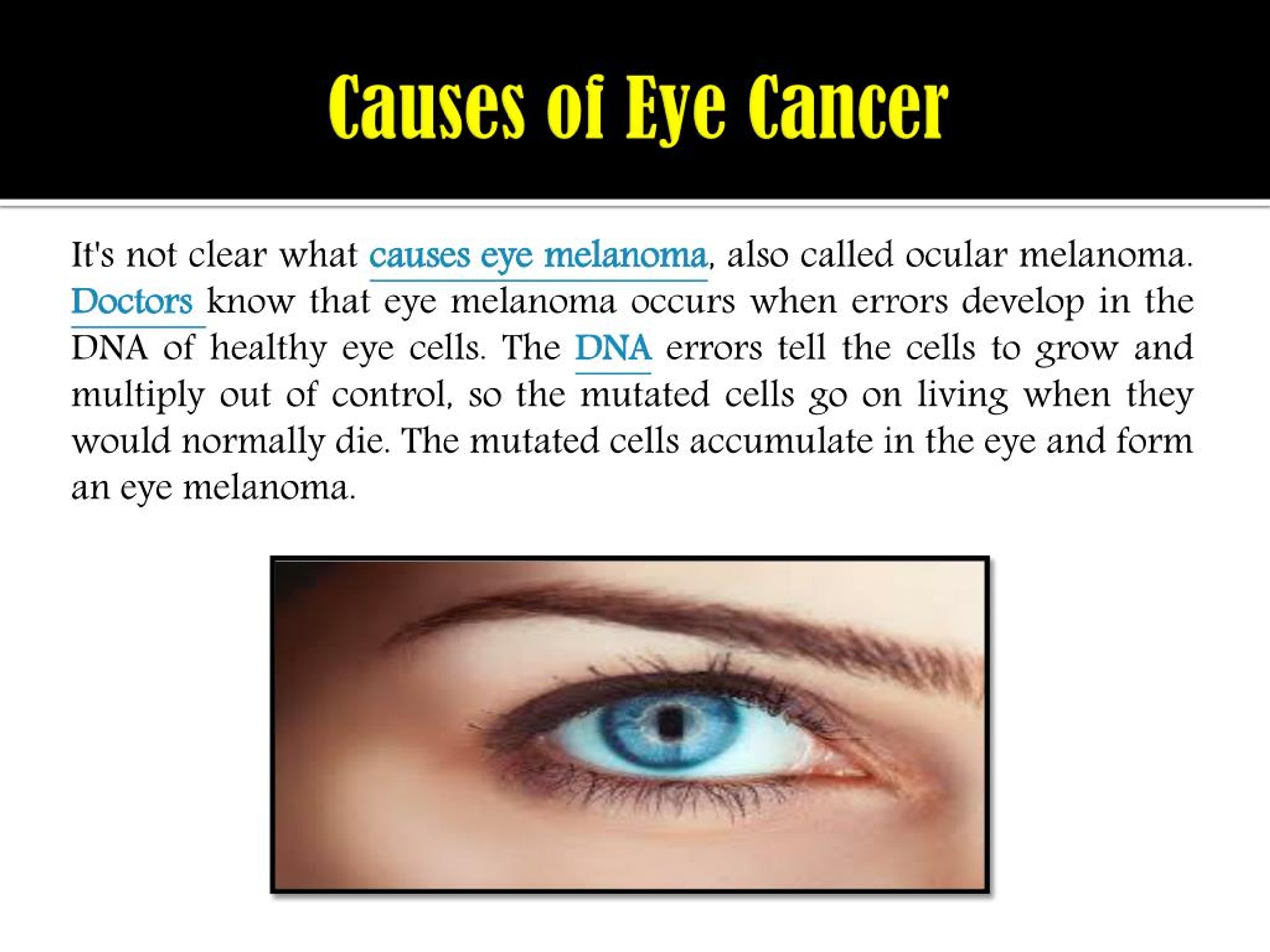 Ppt Eye Cancer Eye Melanoma Symptoms Causes Diagnosis And