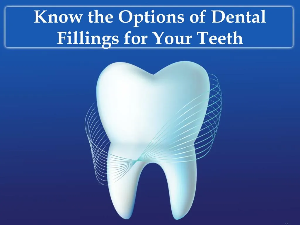 know the options of dental fillings for your teeth n.