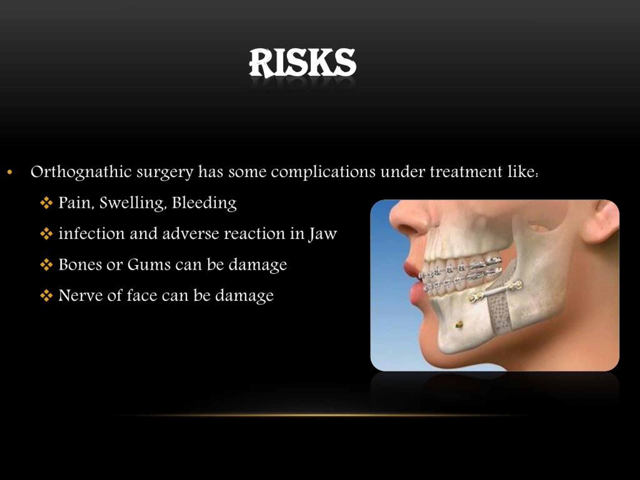 Ppt Orthognathic Surgery By Dr Gregory Casey Powerpoint Presentation