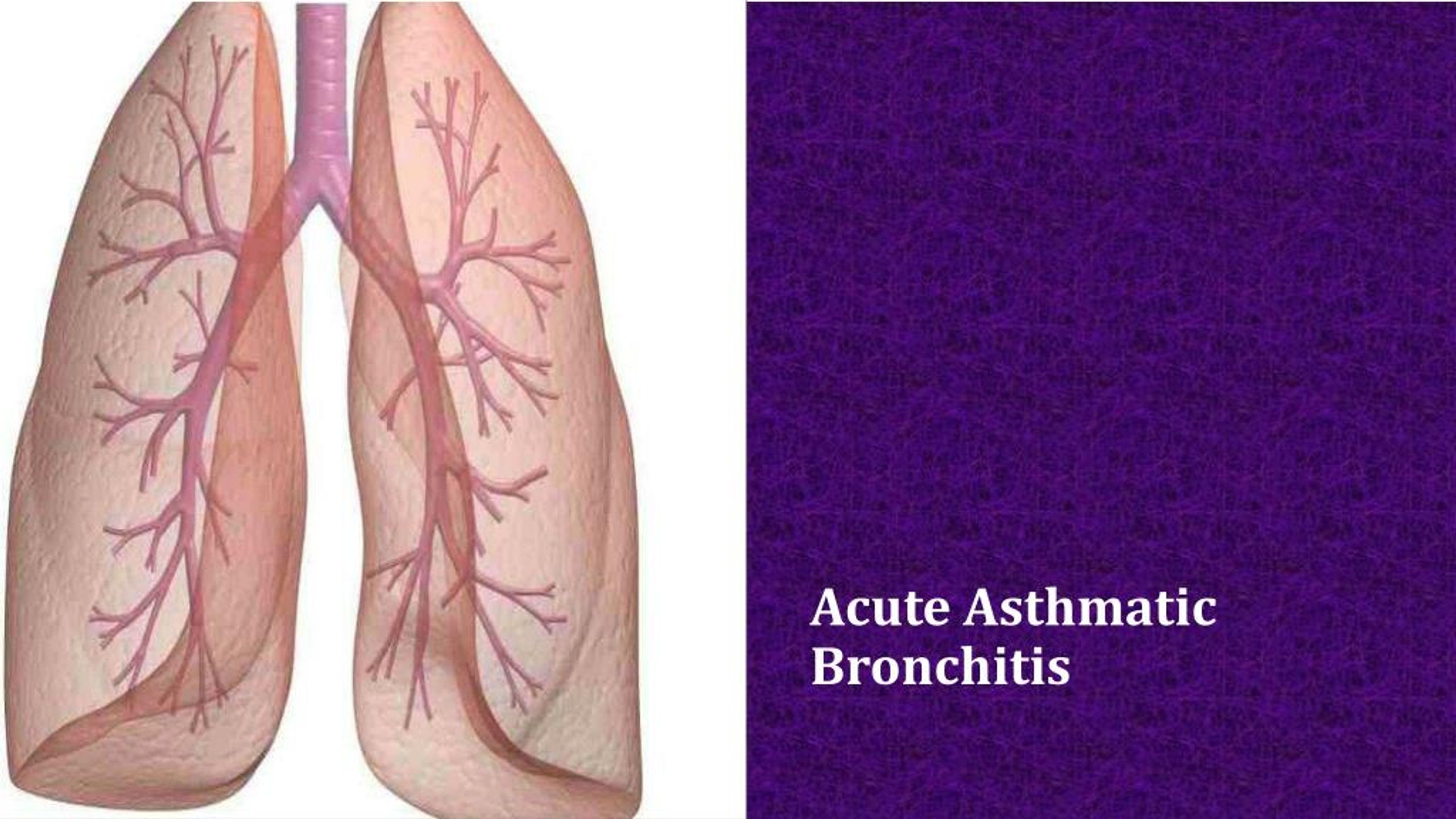 ppt-acute-asthmatic-bronchitis-powerpoint-presentation-free-download