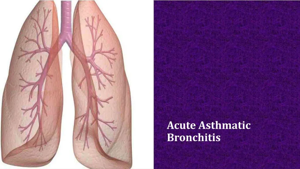 PPT Acute Asthmatic Bronchitis PowerPoint Presentation, free download