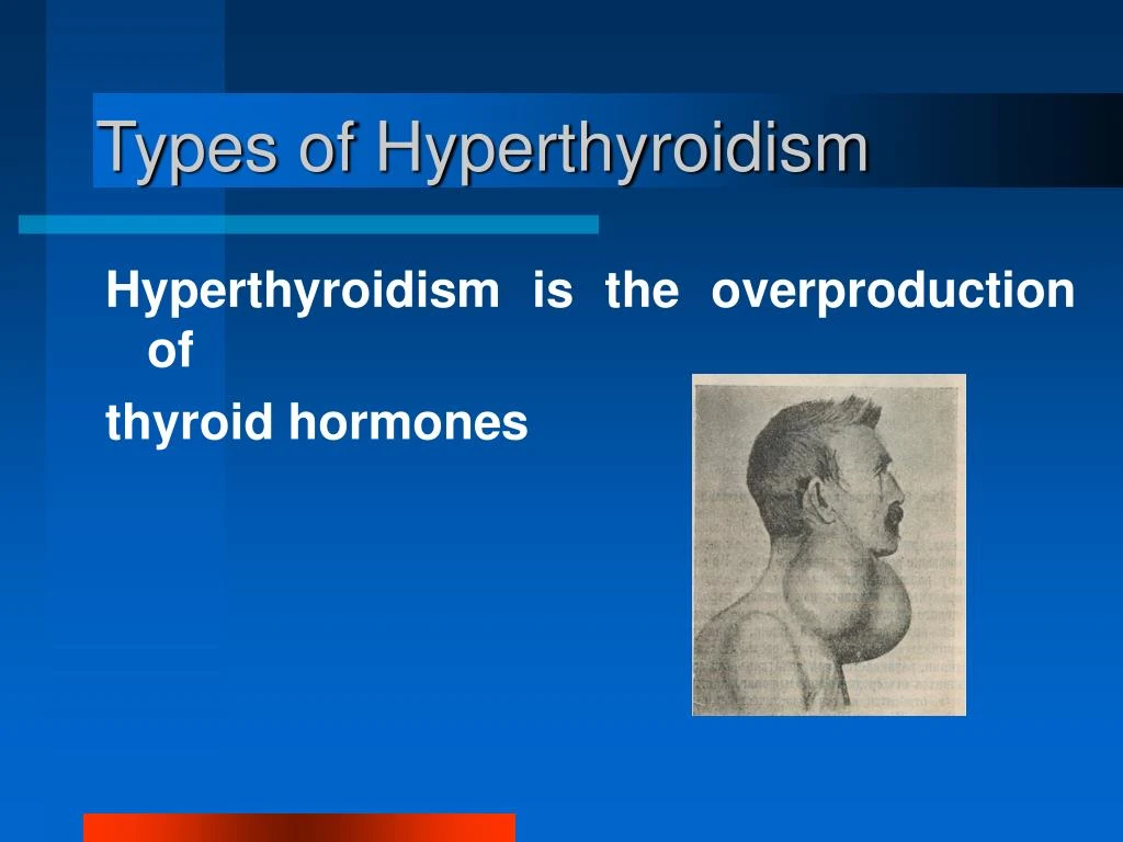 PPT - Thyroid Disease Symptoms PowerPoint Presentation - ID:7517519