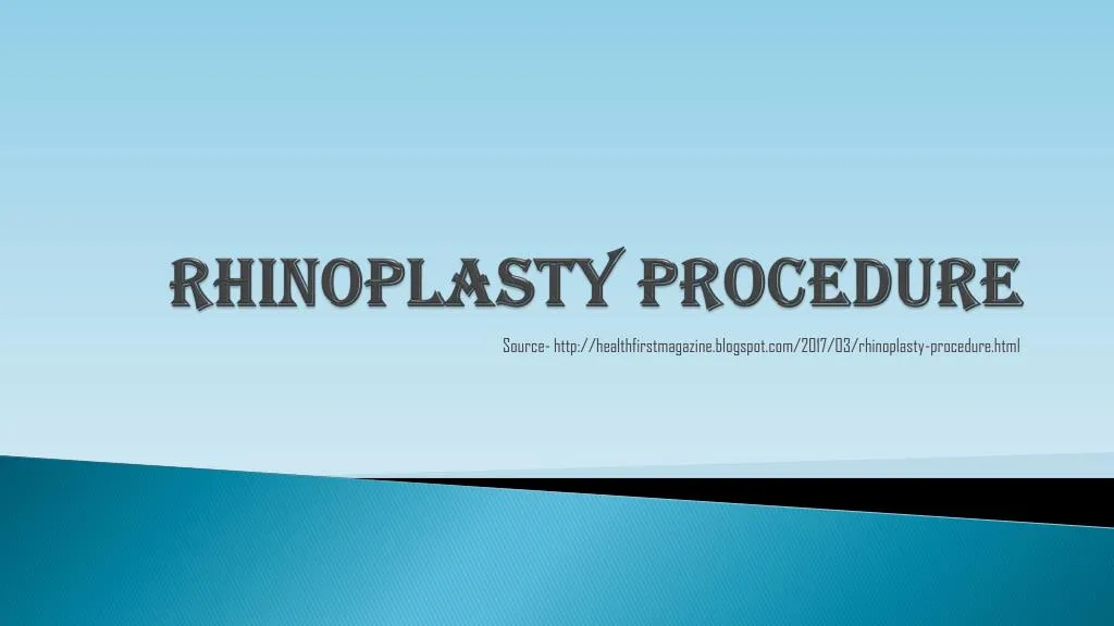 rhinoplasty procedure n.