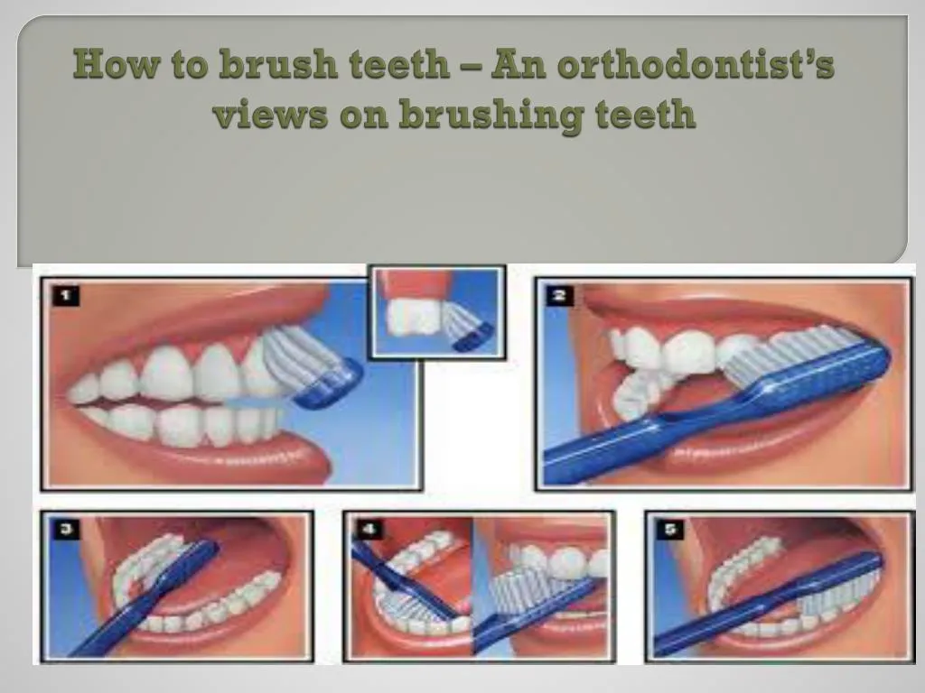 how to brush teeth an orthodontist s views on brushing teeth n.