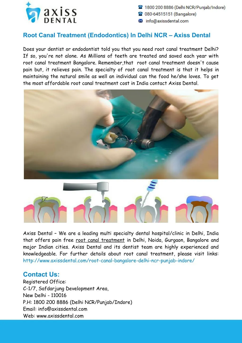 root canal treatment endodontics in delhi n.