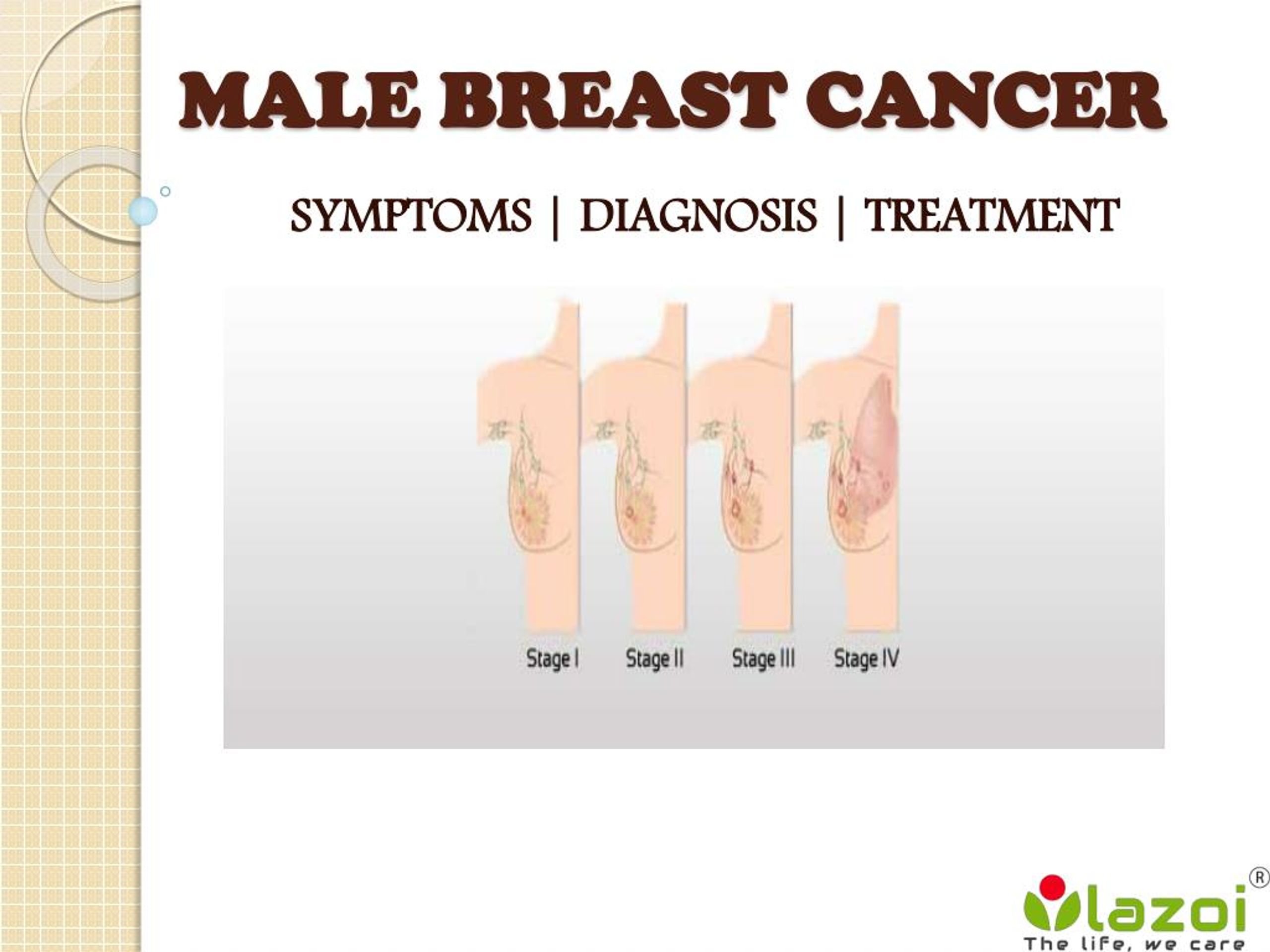 PPT - Male Breast Cancer : Symptoms, diagnosis and treatment PowerPoint  Presentation - ID:7545951