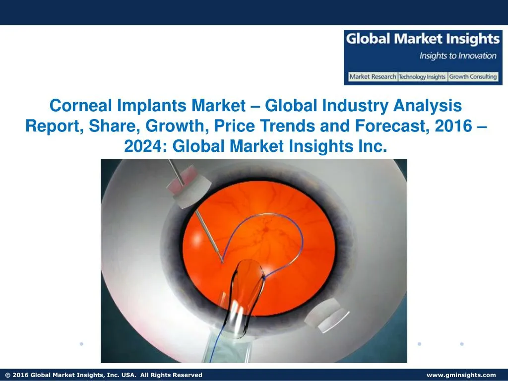 corneal implants market global industry analysis n.