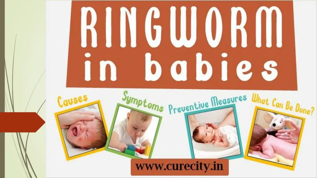 Ppt How To Treat Ringworm In Babies Curecity Powerpoint Presentation Id 7551939