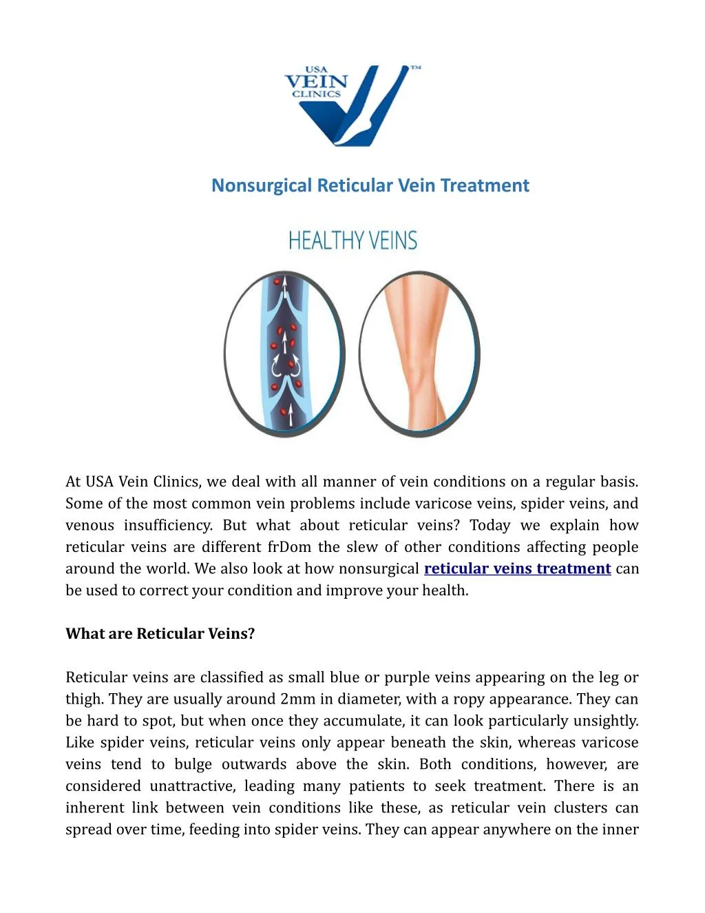 nonsurgical reticular vein treatment n.