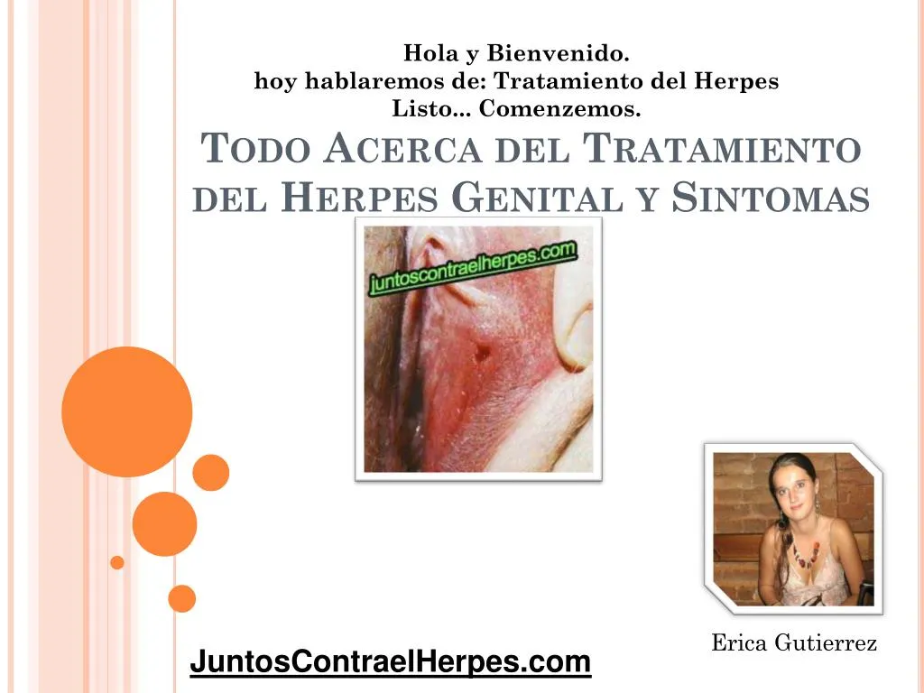 todo acerca del tratamiento del herpes genital y sintomas n.