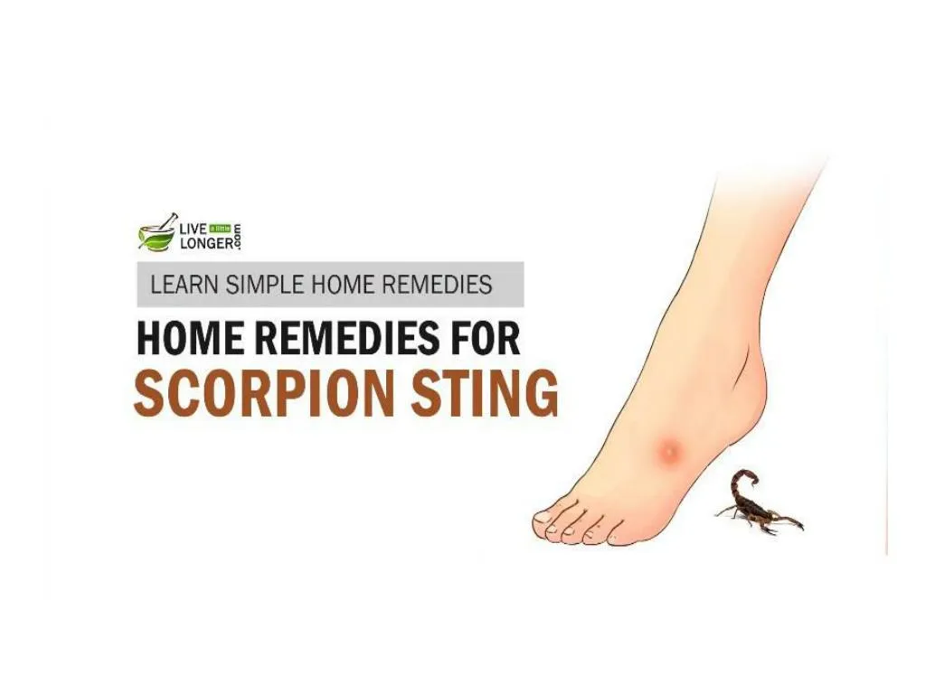 PPT - Best Home Remedies For Scorpion Stings PowerPoint Presentation ...