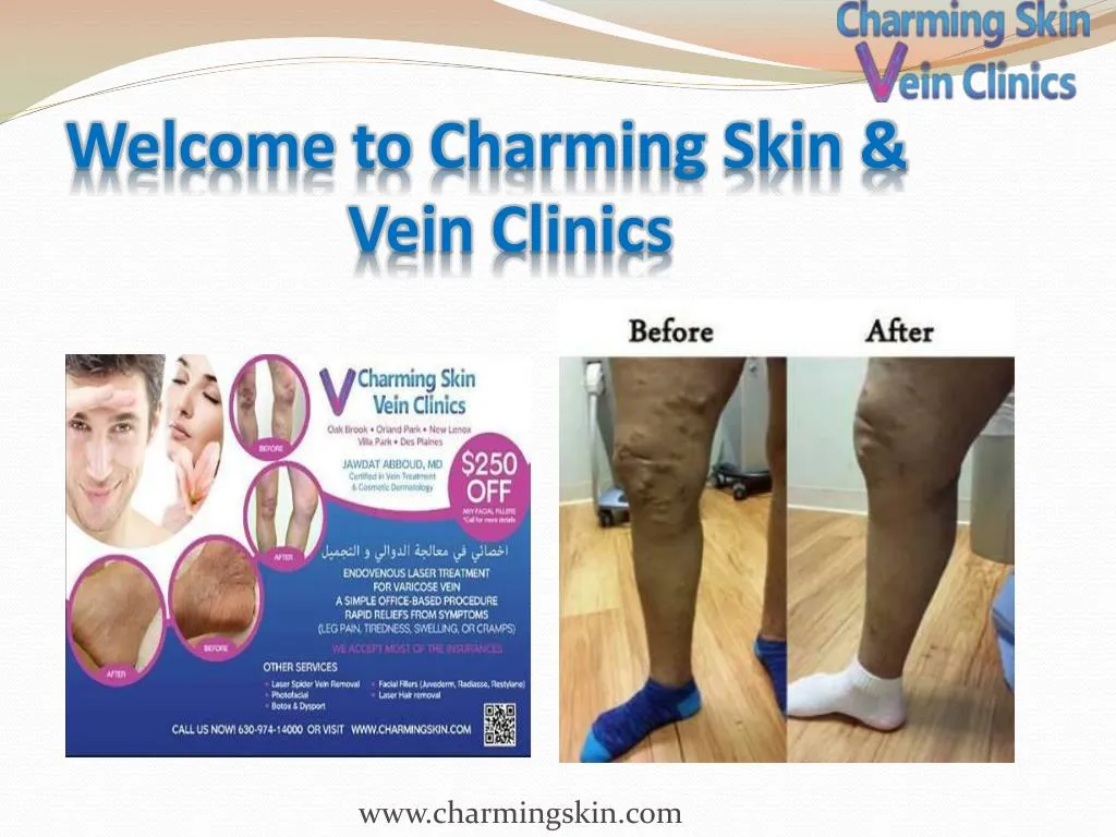welcome to charming skin vein clinics n.