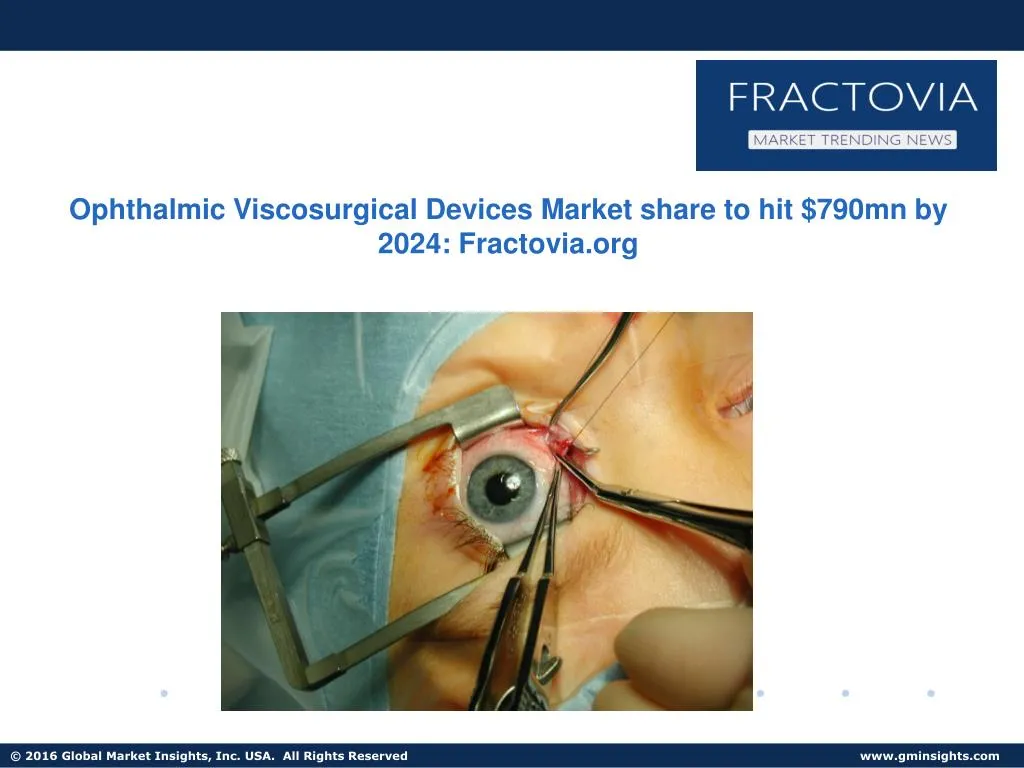ophthalmic viscosurgical devices market share n.