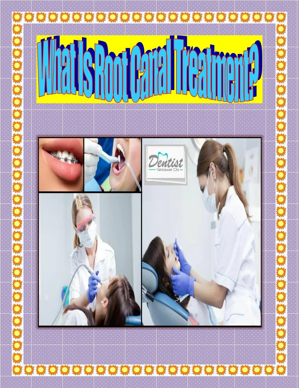 PPT - What Is Root Canal Treatment? PowerPoint Presentation, Free ...