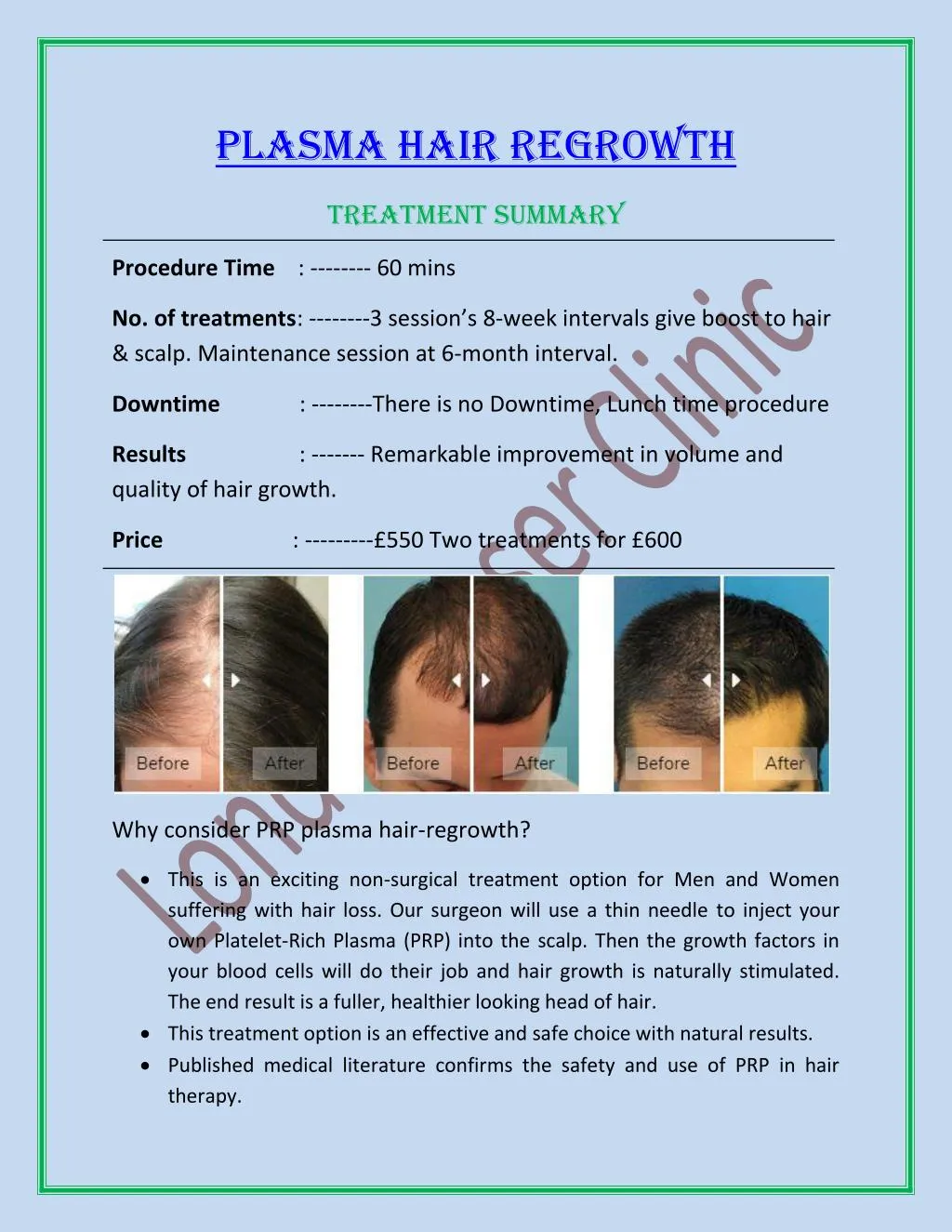 plasma hair regrowth n.
