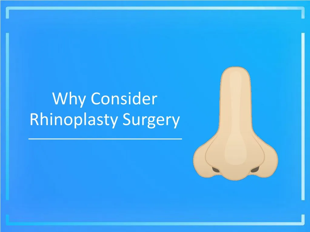 why consider rhinoplasty surgery n.