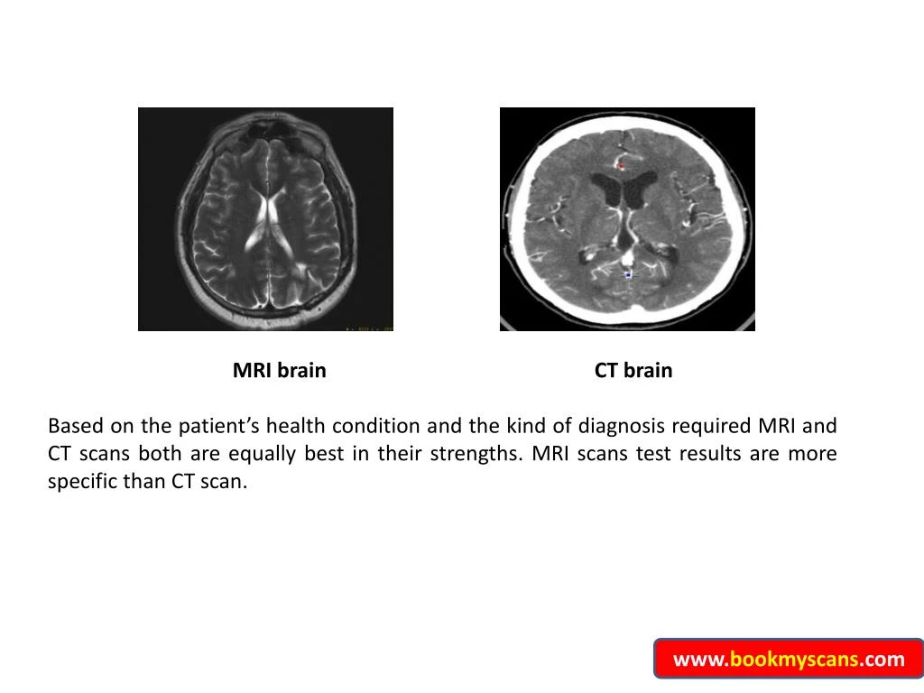 Ppt - Mri Vs Ct Scans In Bangalore - Bookmyscans Powerpoint 