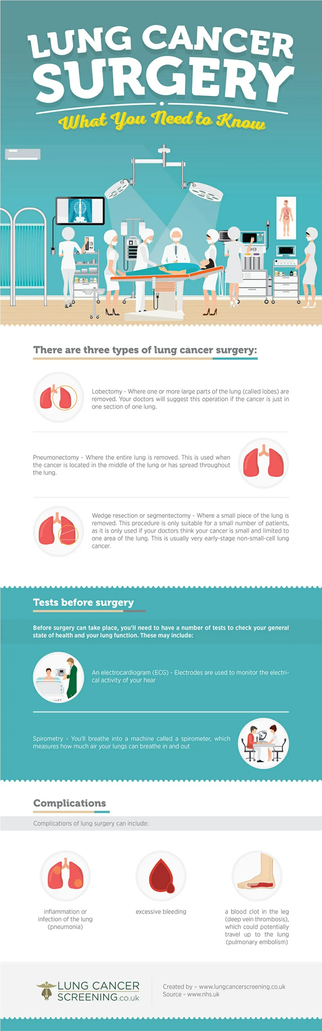 PPT - Lung Cancer Surgery - What You Need to Know PowerPoint ...