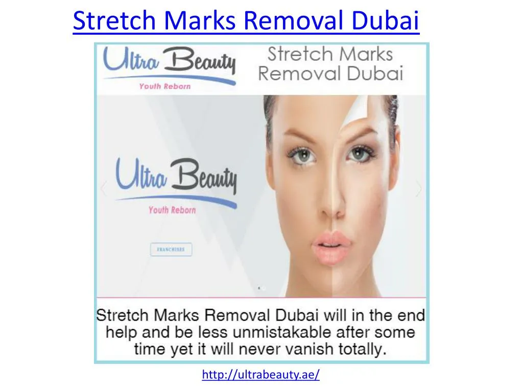 PPT Get more protection from Stretch Marks removal in Dubai