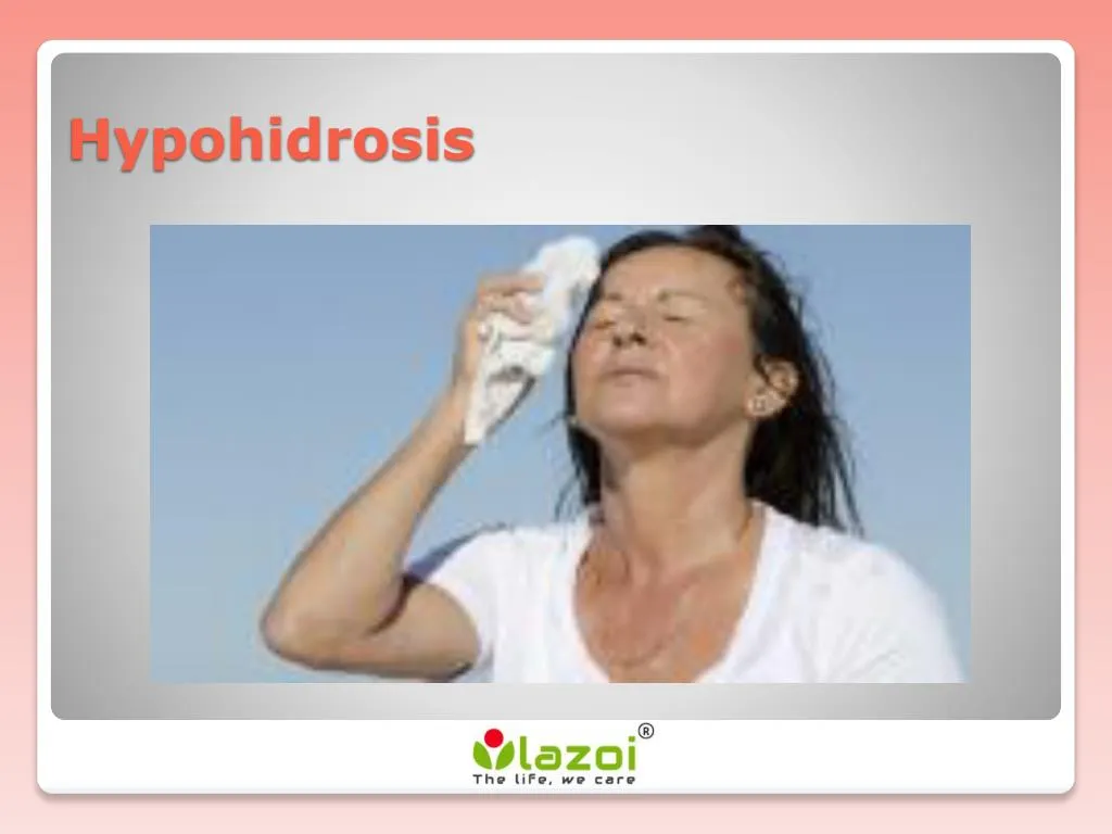 hypohidrosis treatment