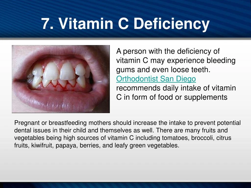 PPT - What Causes Bleeding Gums PowerPoint Presentation - ID:7633966