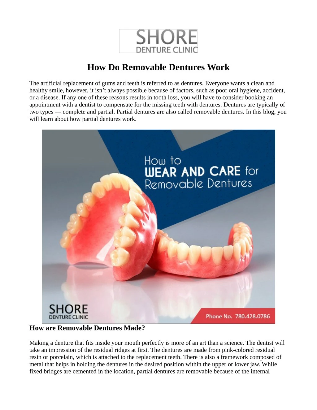 PPT How Do Removable Dentures Work PowerPoint Presentation, free