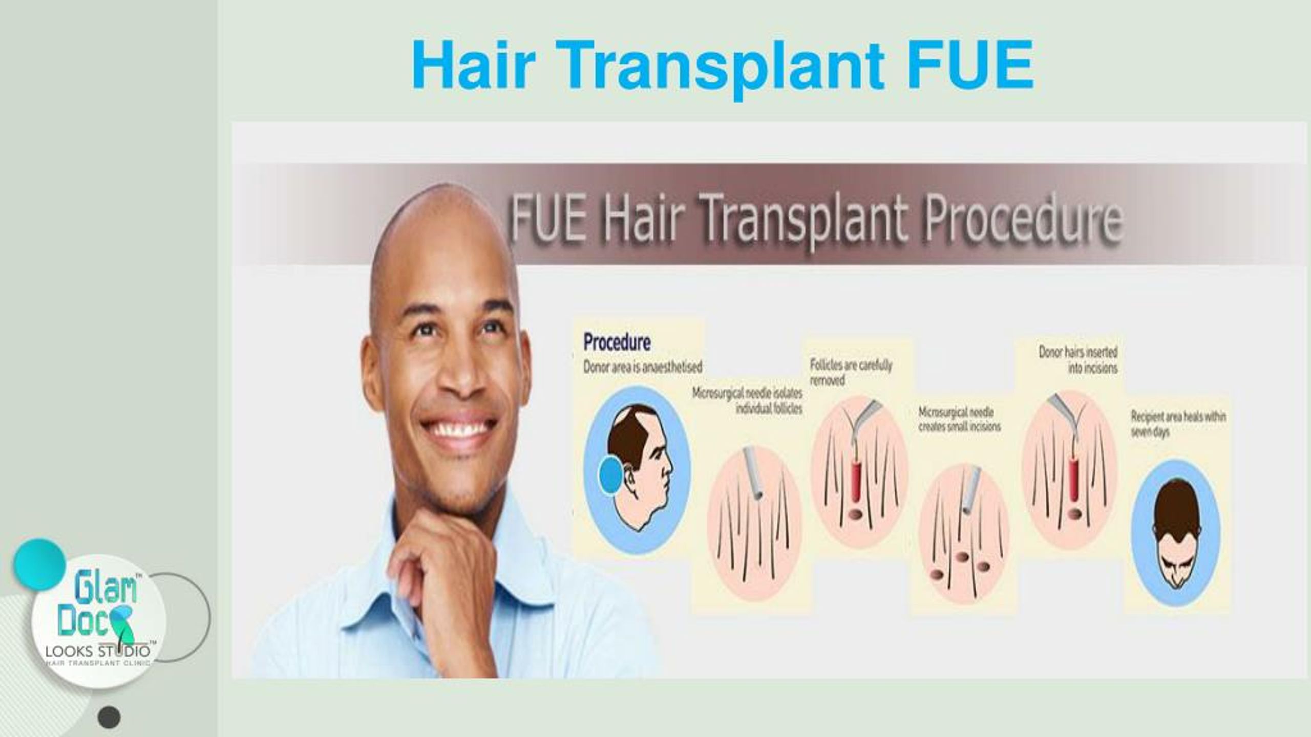 PPT - Glamdoc LOOKSSTUDIO Hair transplant clinic PowerPoint Presentation -  ID:7661718