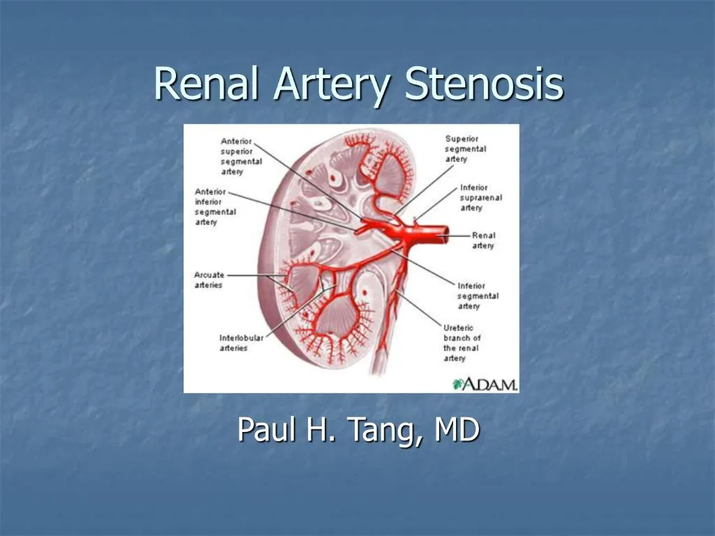 Ppt Renal Artery Stenosis Powerpoint Presentation Free Download Id766262 4837