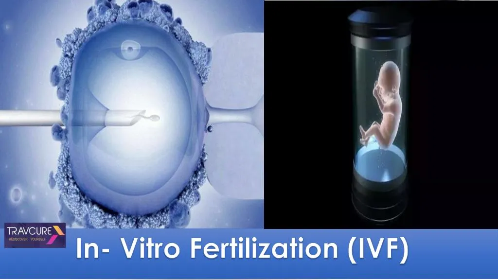 PPT - In Vitro Fertilization (IVF) PowerPoint Presentation, Free ...