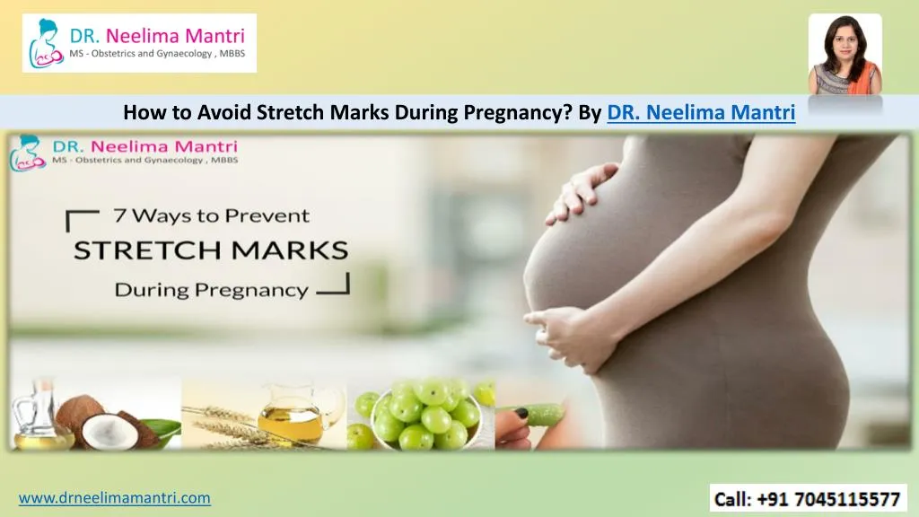 Ppt How To Avoid Stretch Marks During Pregnancy By Dr Neelima Mantri Powerpoint Presentation 