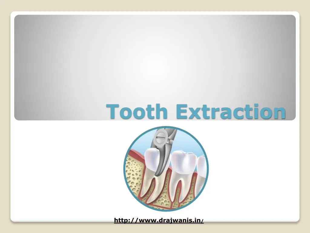 PPT - Tooth Extraction by Best Orthodontist in Pune – Dr. Ajwani ...