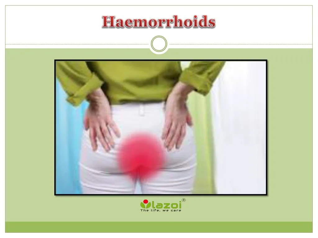 Piles Haemorrhoids Causes Symptoms And Treatment